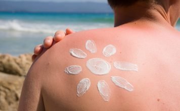 Sunburn and suncream on the shoulder of a young man