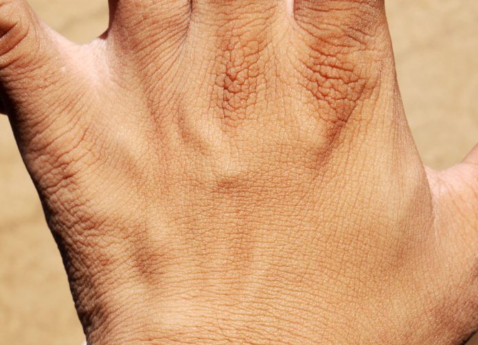 hand human skin texture