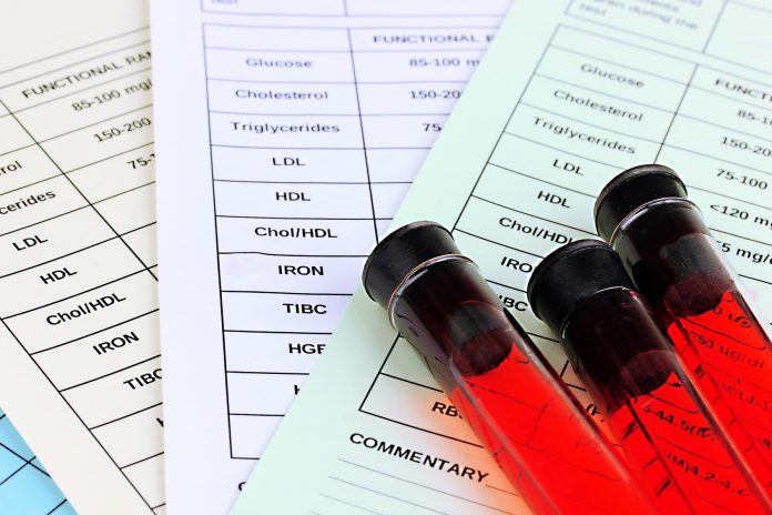 Blood in test tubes and results close up